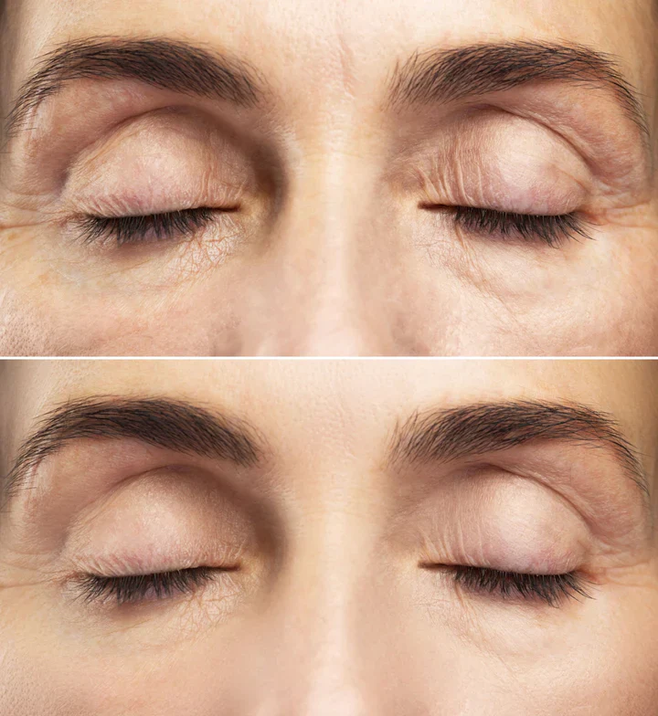 Intense Eye Revive (mtl 2) - Image 4
