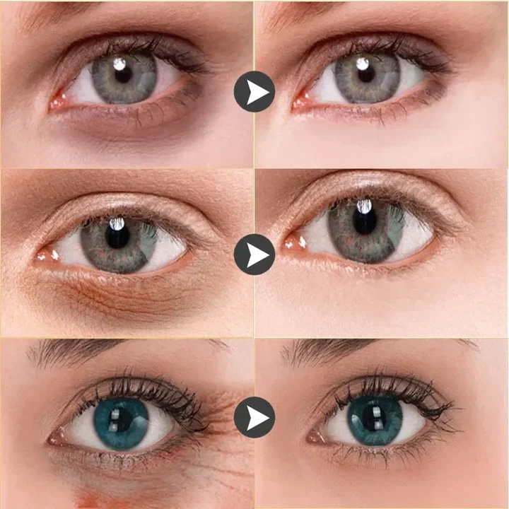 Intense Eye Revive (mtl 2) - Image 6