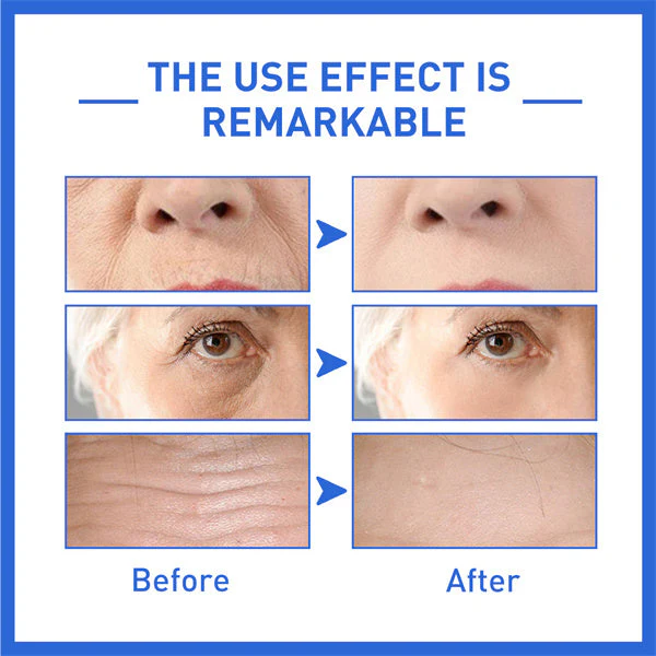 Last Day Promotion 70% OFF - š„2023 New Collagen Boost Permanent Anti-Aging Serum - Image 12